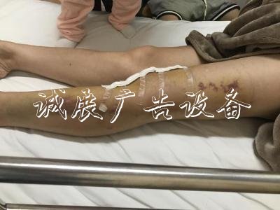 赖女士姐姐受伤不轻